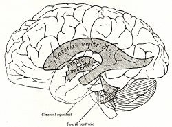 periventricular-leukomalacia